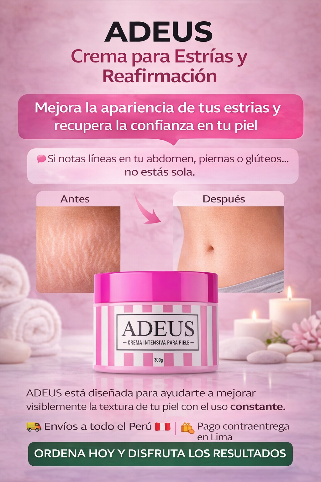 CREMA PARA ESTRIAS Y REAFIRMACION