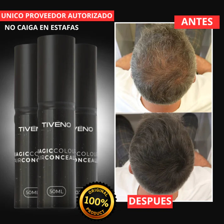 Tiveno® - Pigmento Capilar Masculino